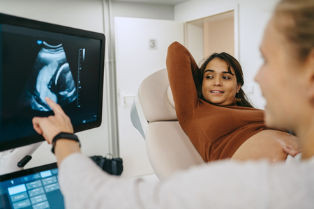 pregnant woman and technician look at a baby on sonogram screen