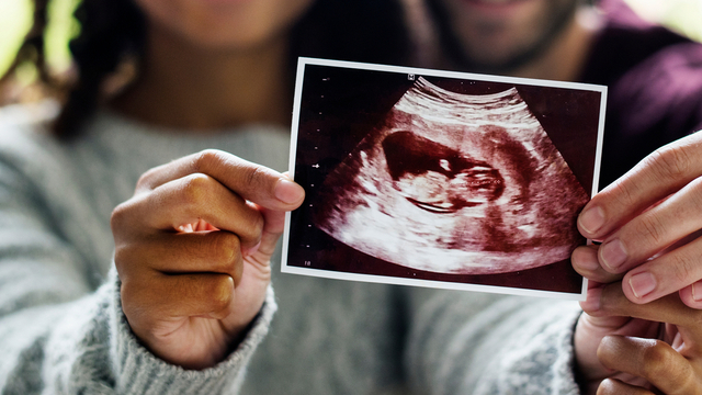 smiling man and woman holding ultrasound photo of baby
